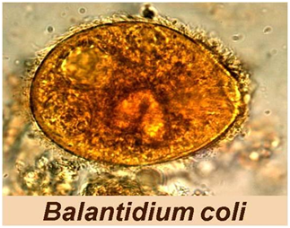 Ảnh 3 của Nhiễm trùng lông Balantidium